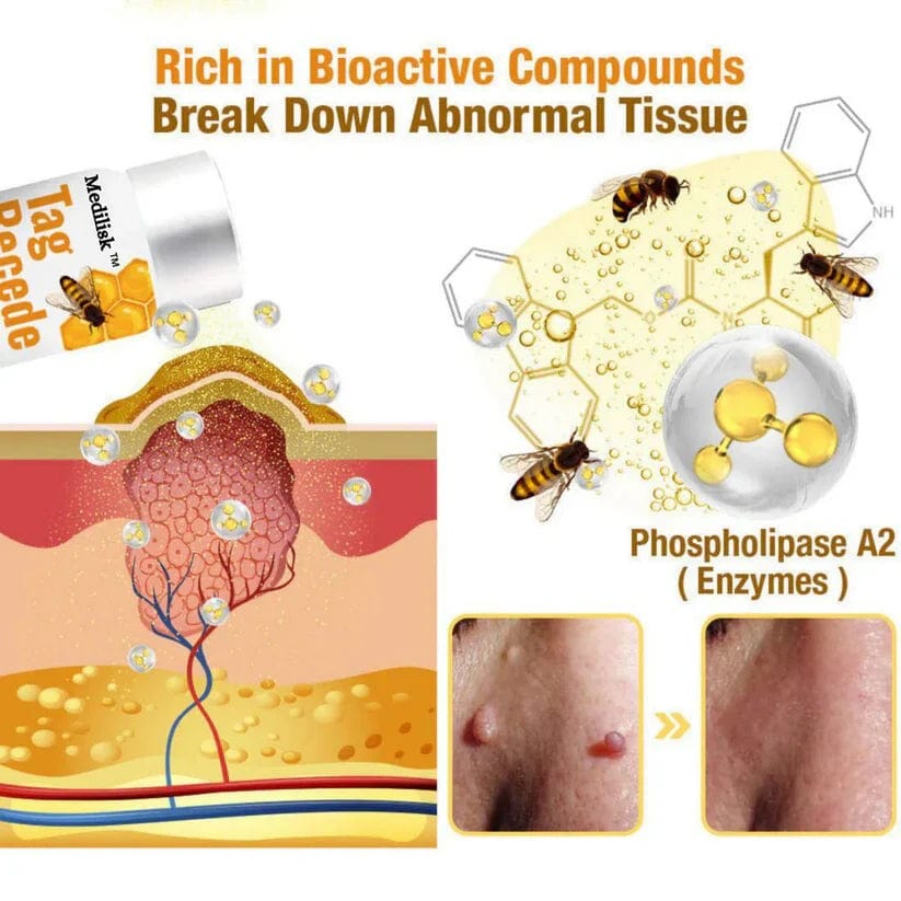 BeeClear™️ Bee Wart Remover Spray