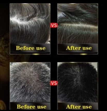 3-in-1 Black Hair Dye Shampoo (Ayurvedic No Side Effect) - 100% Grey Coverage