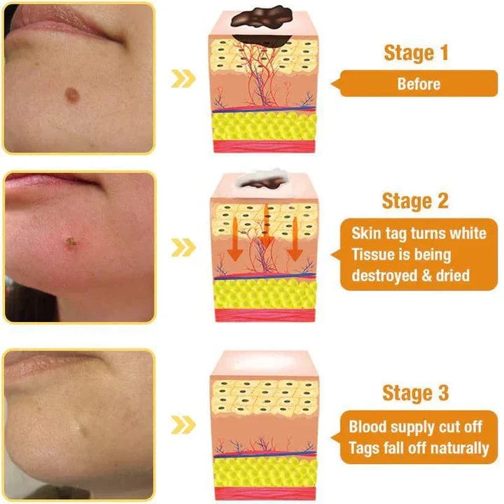 Bee Extract Tag Remover Spray (Pack of 2)