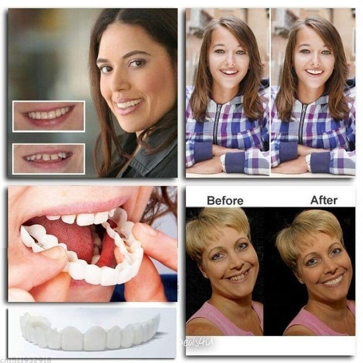 Ezysmyl™️ Snap-On Dentures