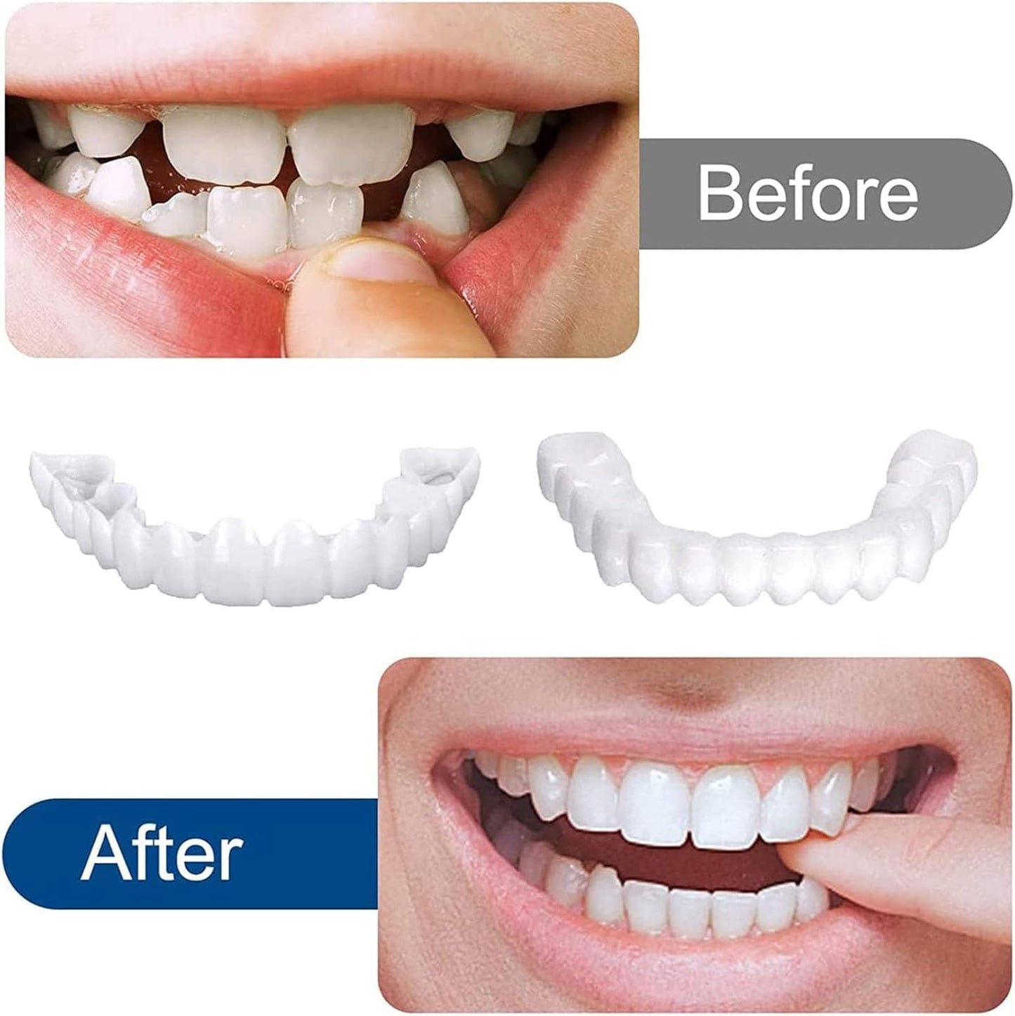 Ezysmyl™️ Snap-On Dentures