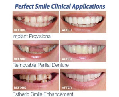 Ezysmyl™️ Snap-On Dentures