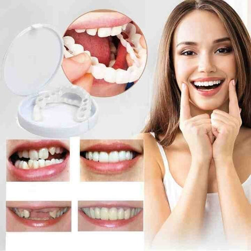 Ezysmyl™️ Snap-On Dentures