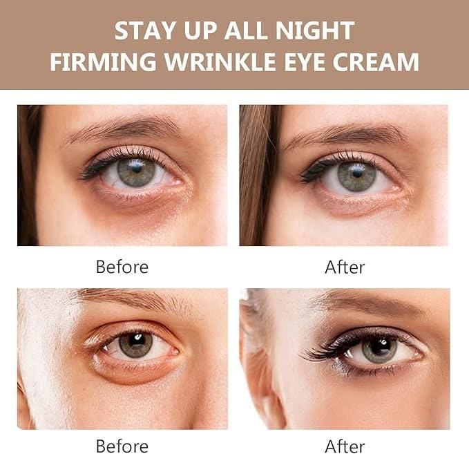 Celyn™️ Instant Firm Eye Bag Cream (Pack of 2)