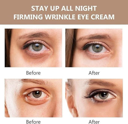Celyn™️ Instant Firm Eye Bag Cream (Pack of 2)