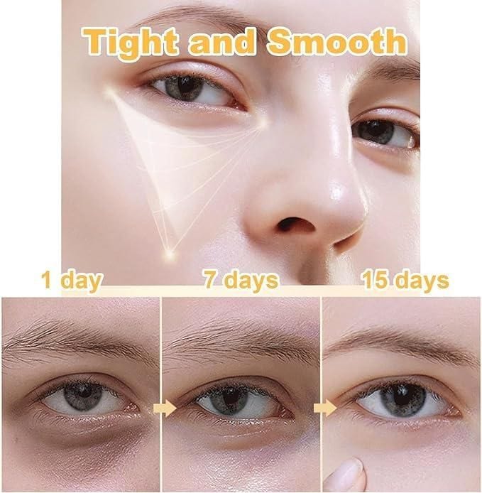 Celyn™️ Instant Firm Eye Bag Cream (Pack of 2)