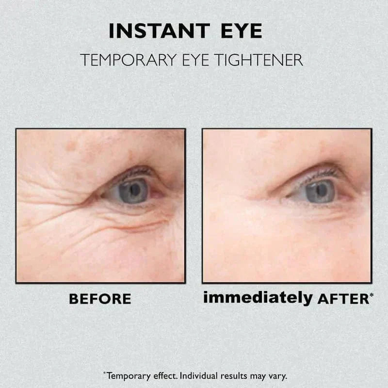 Celyn™️ Instant Firm Eye Bag Cream (Pack of 2)
