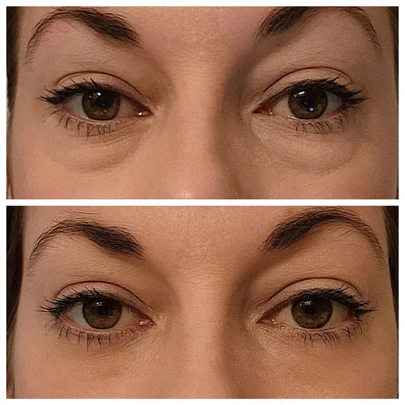 Celyn™️ Instant Firm Eye Bag Cream (Pack of 2)