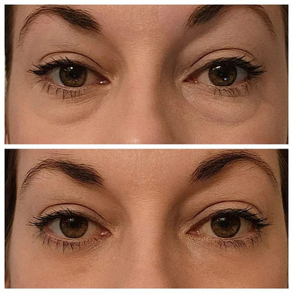 Celyn™️ Instant Firm Eye Bag Cream (Pack of 2)