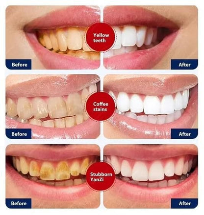 Smoke Stains White Plus Toothpaste (Pack of 2)